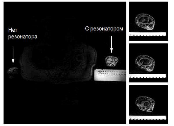 Разбираем магнитно-резонансный томограф II: Метаматериалы в МРТ