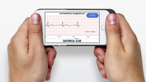 Сделано в России: электрокардиограф CardioQVARK выполнен в виде чехла для смартфона